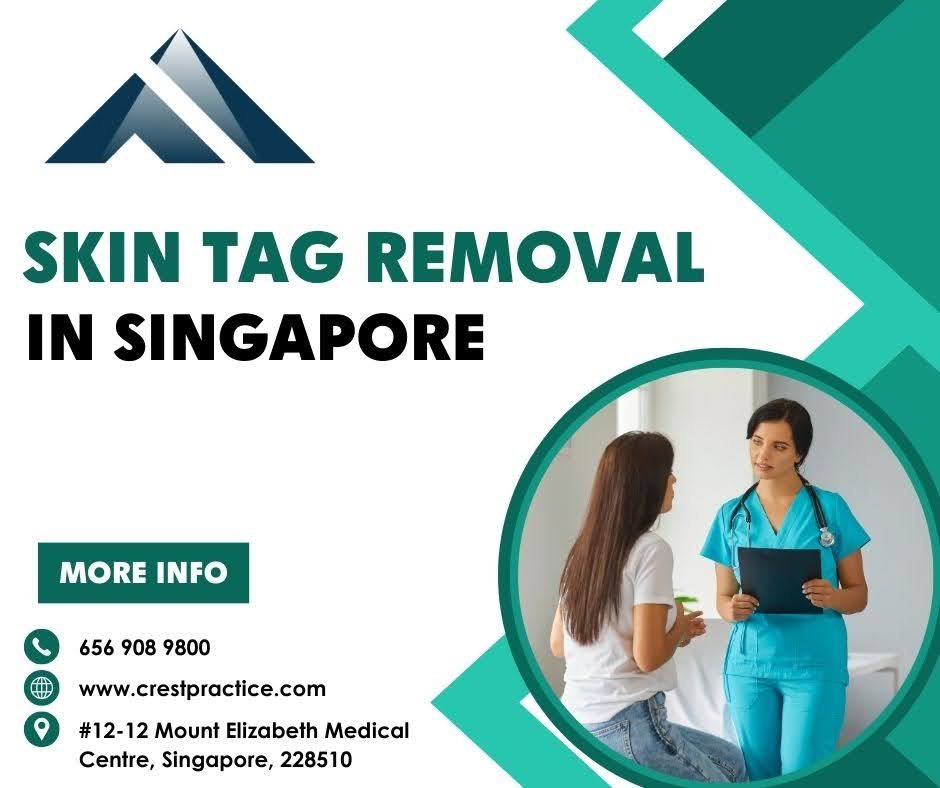 skin tag removal in Singapore