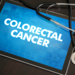 Colorectal cancer surgery in Singapore