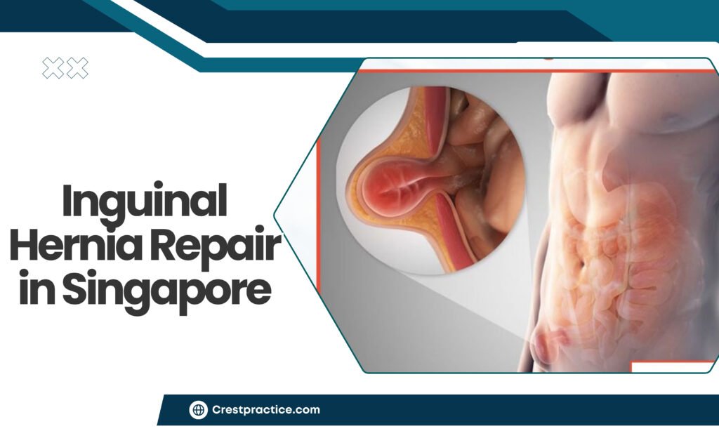 Understanding Hernia Surgery Costs and Recovery in Singapore